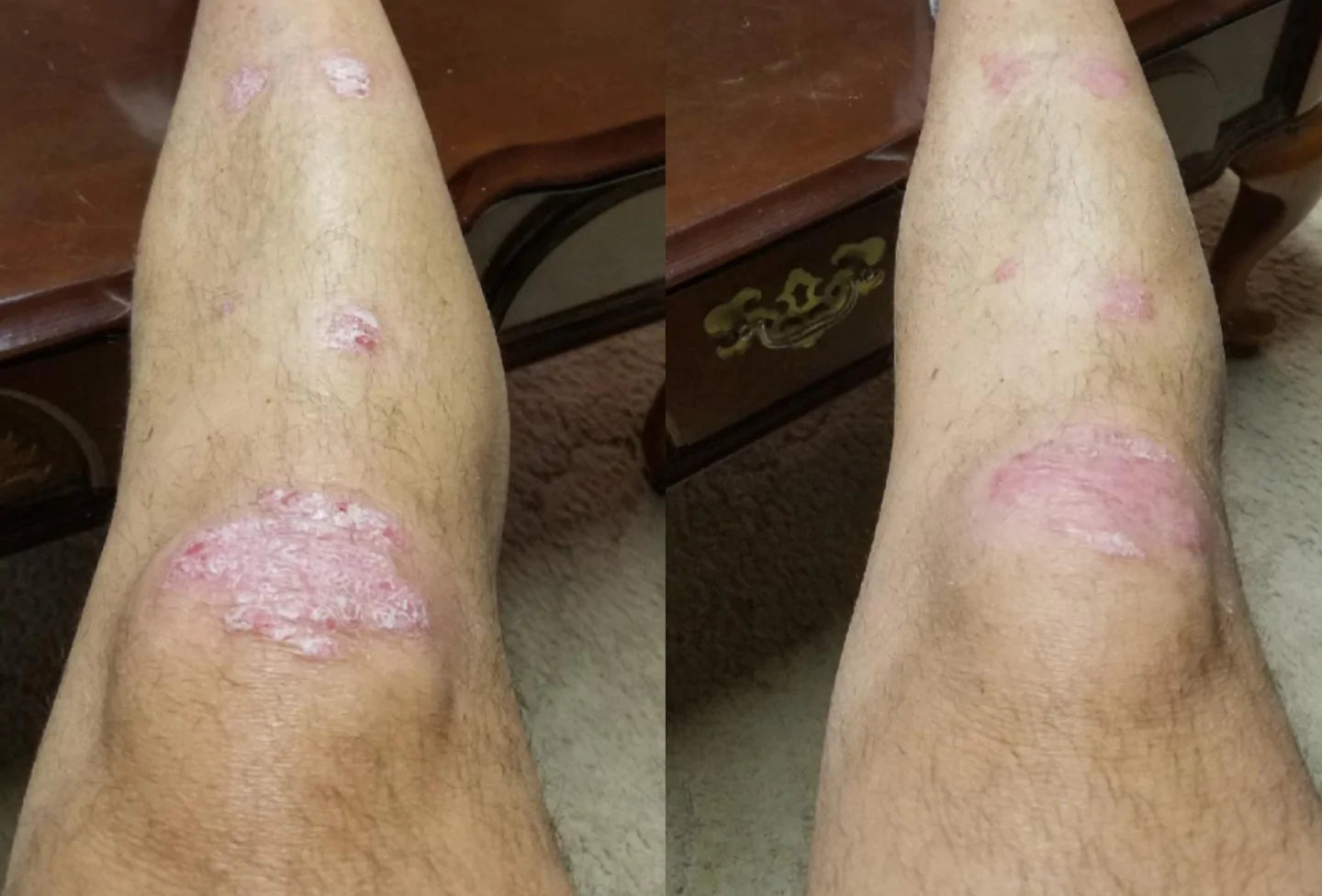 Relief & Heal Natural Therapeutic Body Wash & Body Lotion Set (Lemongrass, Tea Tree, Bergamot)